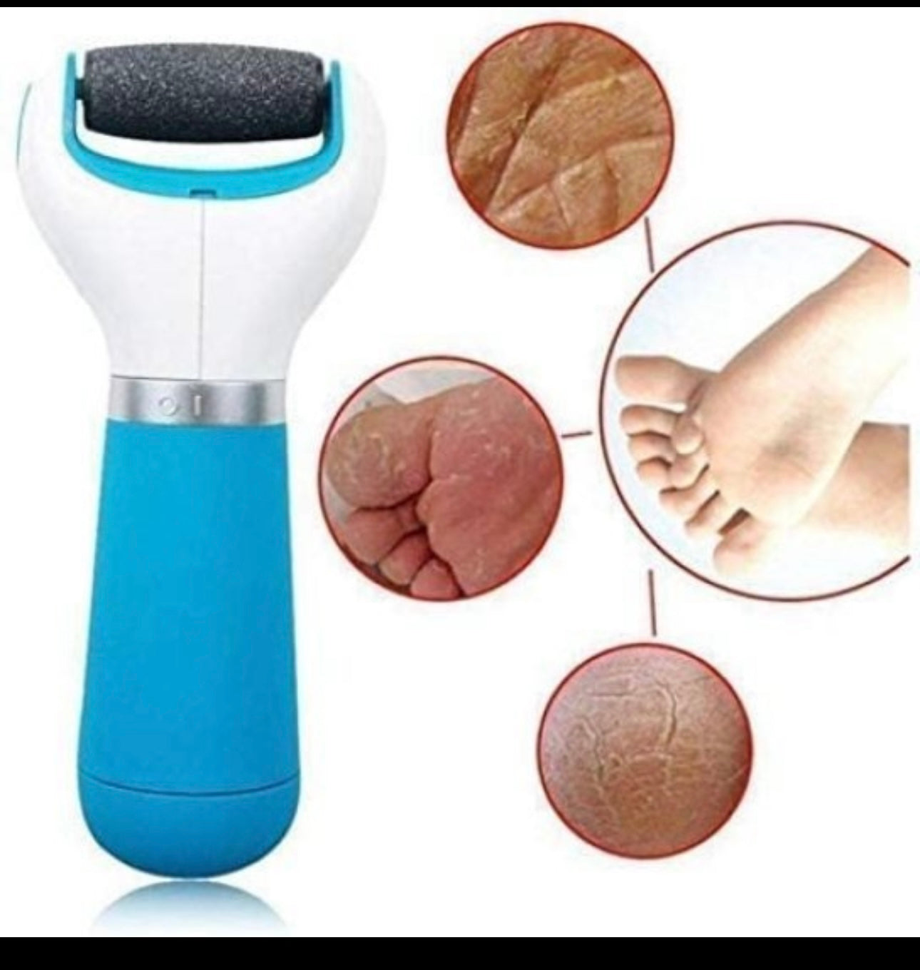 Pedicure Spin Foot Roller Dead Skin Remover