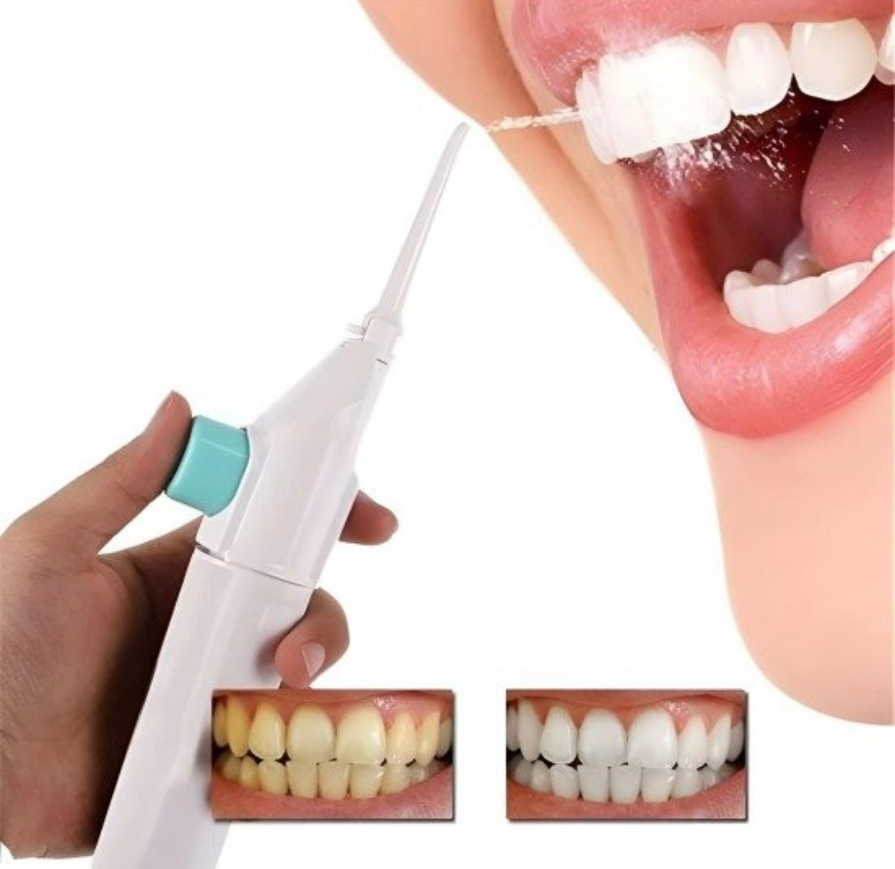 Power Floss Dental Water Flosser